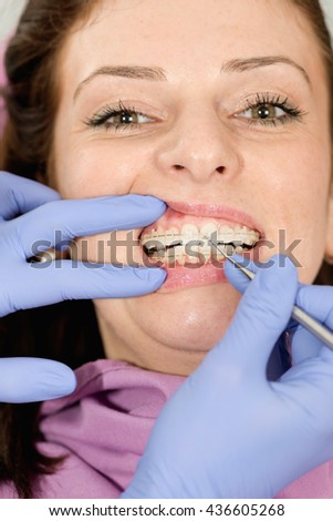 Orthodontist checking transparent ceramic braces on young patient