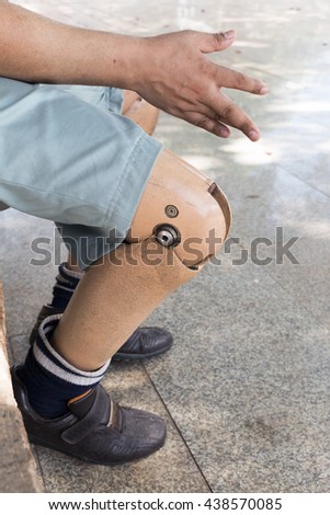 prosthetic leg, The poor amputee with his old prosthesis using