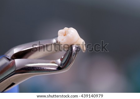 Dental equipment holding an extracted tooth Royalty-Free Stock Photo #439140979