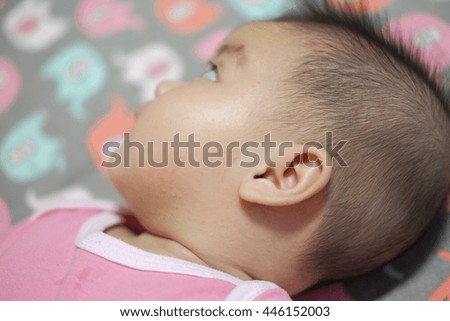 allergy on face in newborn baby.