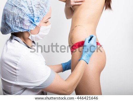 Female doctor makes dotted line on female body for cellulite correction. cosmetic surgery. lifting and breast augmentation.