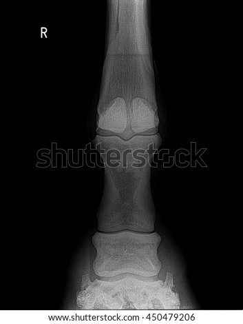  hores front right  leg xray picture.