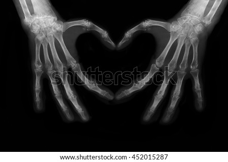 Bones of hands making the sign of love