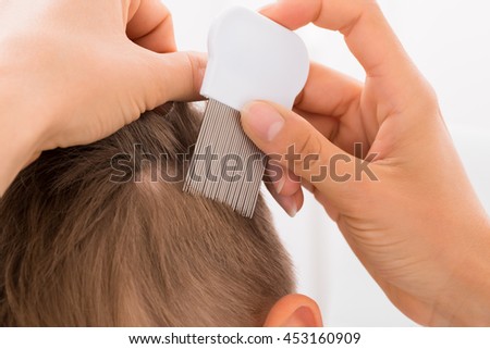 Close-up Of Female Doctor Doing Treatment On Boy's Hair With Comb