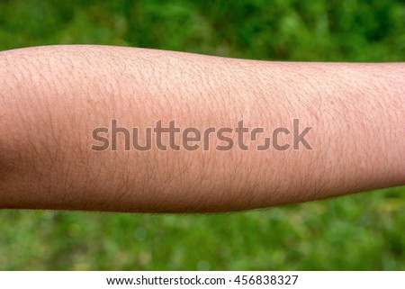 Female with hairy arm