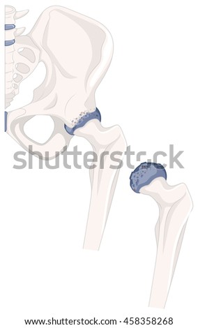Hip bone of human  illustration