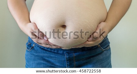 woman's hand holding excessive belly fat - Obesity is caused by the pregnancy. Royalty-Free Stock Photo #458722558