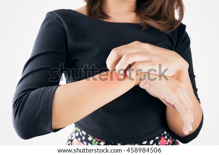 Lady scratch the itch with hand, Wrist, Itching, Concept with Healthcare And Medicine.