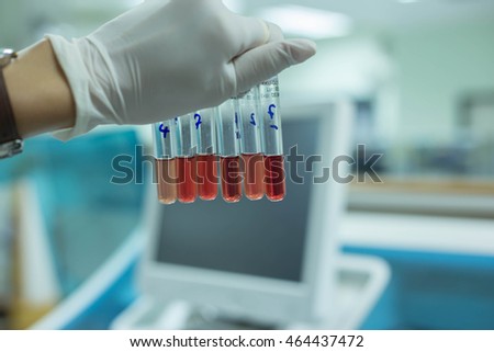 DCIP, laboratory test Royalty-Free Stock Photo #464437472