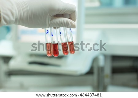 DCIP, laboratory test Royalty-Free Stock Photo #464437481