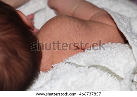 Fine, soft hair called lanugo covers newborn baby's back and arms.
