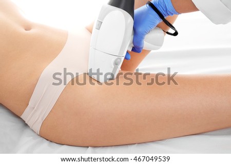 laser hair removal. Woman on laser hair removal treatments thighs and bikini area