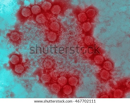 Electron micrograph of canine adenovirus