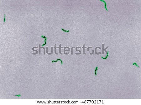 Image of a Photomicrograph of Treponema pallidum bacteria