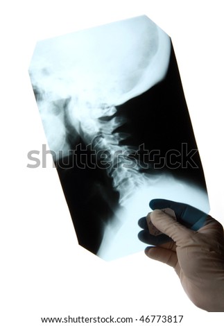 surgeon holding roentgenogram of the human cervical spine on white background