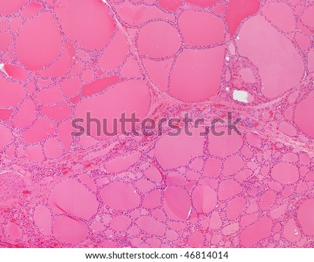 Microscope Picture of Human Thyroid Gland