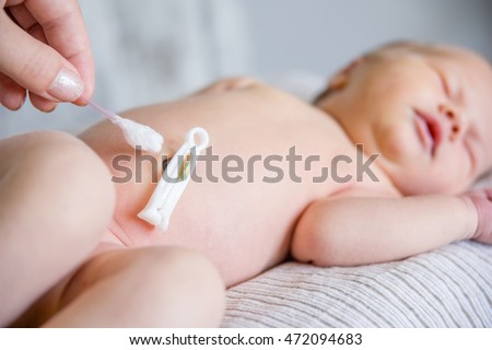 Treatment of newborn baby navel with a cotton swab. Royalty-Free Stock Photo #472094683