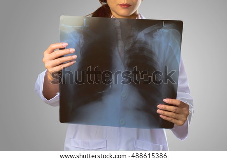 Female doctor looking at the x ray picture of lungs