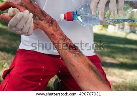 Paramedic cooling third degree hand burns with water. Simulated exercise, professional medical make-up, not a real injury. Royalty-Free Stock Photo #490767031