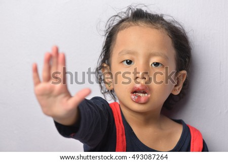 Portraiture of kid injuries on lips with available low light photography