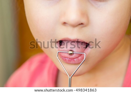 Little girl in class with a speech therapist . The use of special tools for speech correction.