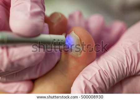 Doctor Podiatry removes calluses, corns and treats ingrown nail. Hardware manicure. Concept body care.
