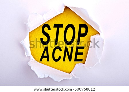 Words Stop Acne on ripped paper - Business, technology, internet concept. Stock Photo