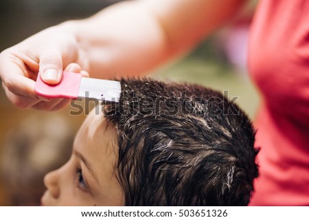 Special comb being used in hair of young boy to pick nits and lice from head. 