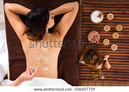 High Angle View Of A Relaxed Young Woman Receiving Cupping Treatment On Back Royalty-Free Stock Photo #506607739
