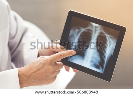 Cropped image of an old doctor in white medical coat showing X-ray picture on a tablet