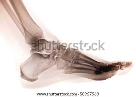 human foot ankel and leg xray picture