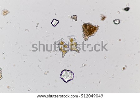 Dinophysis/Dinoflagellate (Marine Protozoa) under microscope