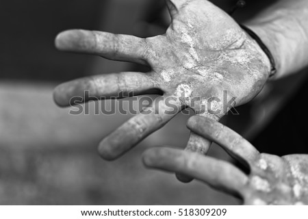 Palms with Calluses. Blisters on the Injured Hands From Manual Work. Hard Work Concept. Royalty-Free Stock Photo #518309209