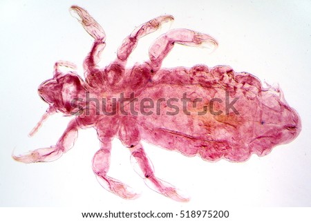 Human body louse Pediculus humanus