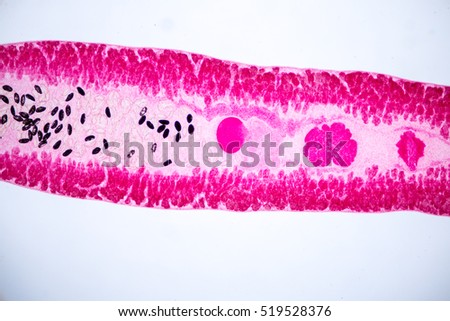 Echinostoma revolutum (parasite) under the microscope