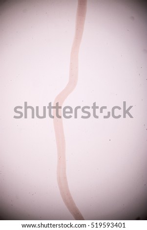 Spiniloculus paigeae (parasite) under the microscope