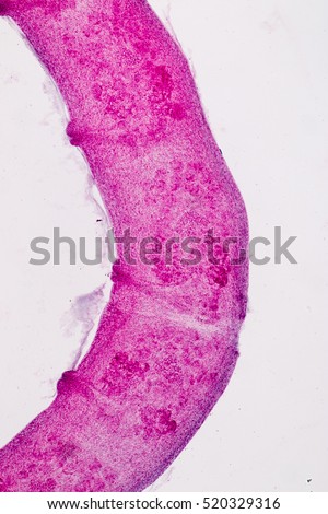 Taenia solium (parasite) under the microscope