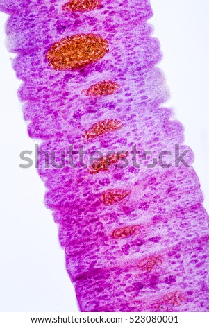 Senga Chiangmaiensis (parasite) under the microscope