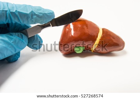 Surgeon's hand in blue latex glove holding scalpel over anatomical figure of human liver. Concept that symbolizes process of surgery treatment of liver diseases such as cancer, hydatid disease ets. Royalty-Free Stock Photo #527268574
