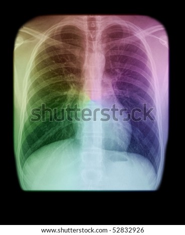 human thorax with different colors, isolated on black background
