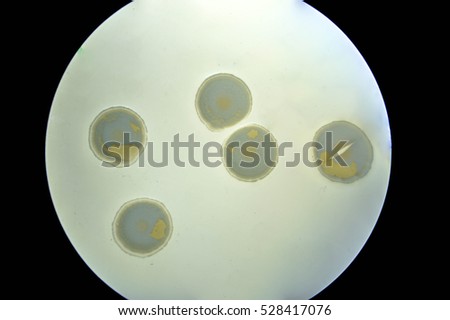 Actinomyces colony characterization on agar plate medium, Colony of Actinomyces under stereo microscope