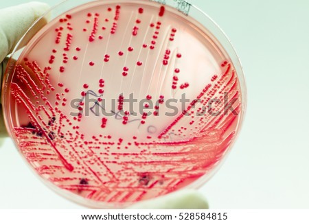 ESCHERICHIA-COLI-ON-MACCONKEY-AGAR Stock Photos and Images - Avopix.com