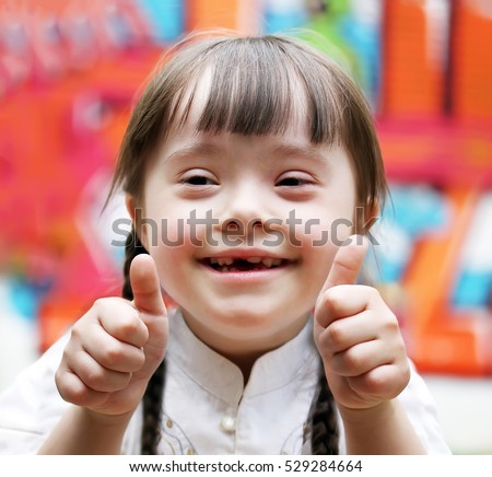 Portrait of beautiful disabled girl that giving thumbs up. Royalty-Free Stock Photo #529284664