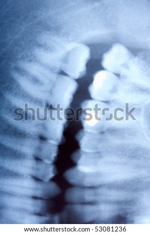 a dental x-ray detail