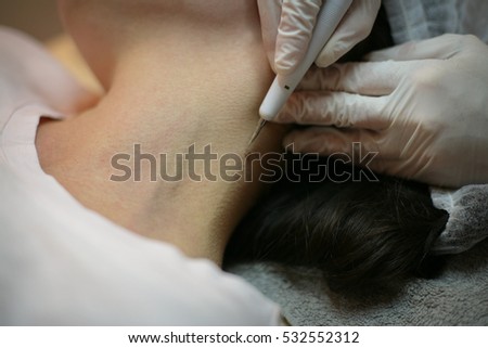 Young woman remove moles from the neck. 