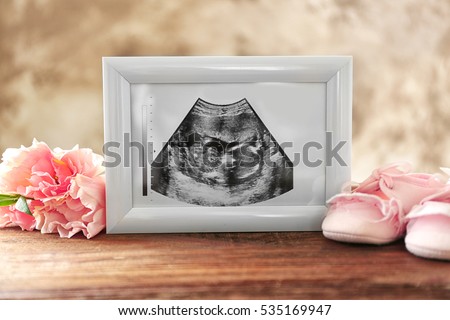 Ultrasound picture of baby in photo frame and children shoes on table