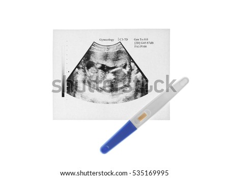 Ultrasound picture of baby and pregnancy test on white background