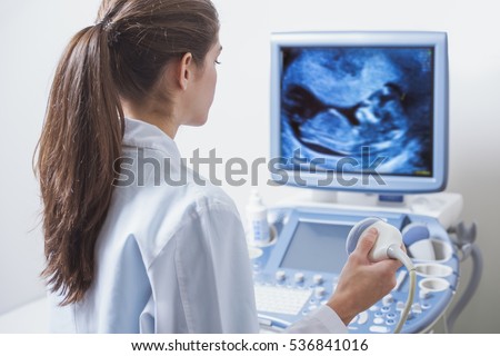 young woman doctor is viewing an ultrasound result to test for visible trisomy 21 signs Royalty-Free Stock Photo #536841016