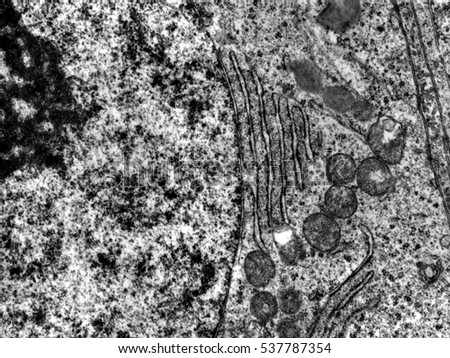 Transmission electron microscope (TEM) micrograph showing a continuity between the nuclear envelope and a cistern of the rough endoplasmic reticulum.  Royalty-Free Stock Photo #537787354