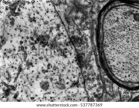 Transmission electron microscope (TEM) micrograph showing two synapses with clear synaptic vesicles. The postsynaptic element (a dendrite) shows ribosomes and cisternae of rough endoplasmic reticulum. Royalty-Free Stock Photo #537787369